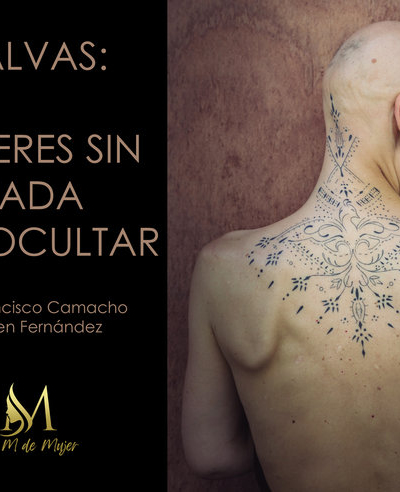 Calvas: Mujeres sin nada que ocultar